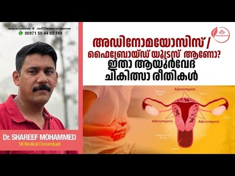 Adenomyosis Malayalam | Adenomyosis Ayurvedic Treatment | അഡിനോമയോസിസ് | Dr Shareef